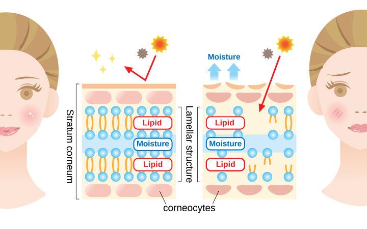 healthy skin and dry skin diagram with woman face