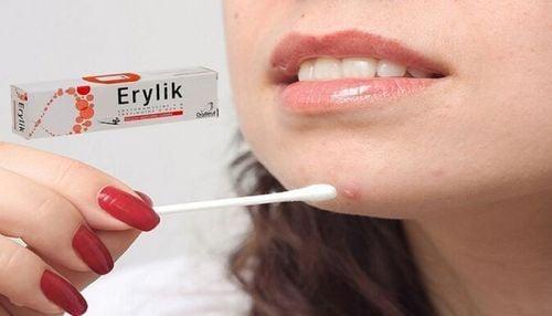 Người bệnh nên dùng thuốc erylik theo đúng hướng dẫn