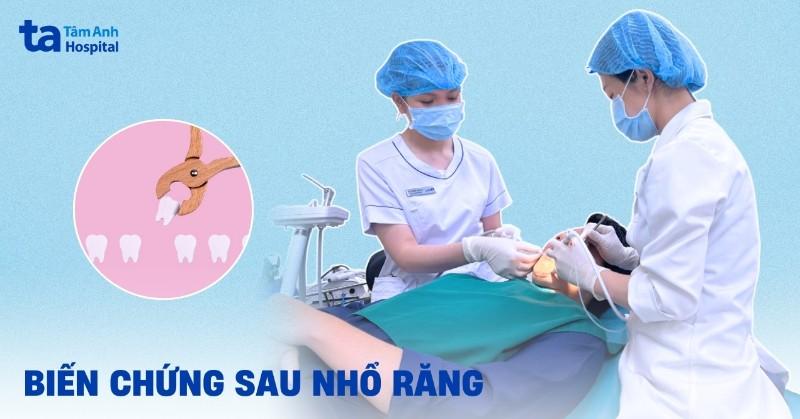 biến chứng sau nhổ răng