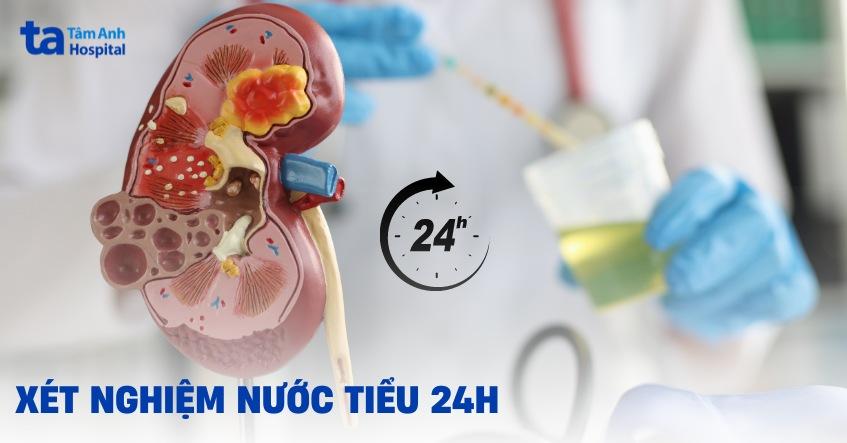 xét nghiệm nước tiểu 24h