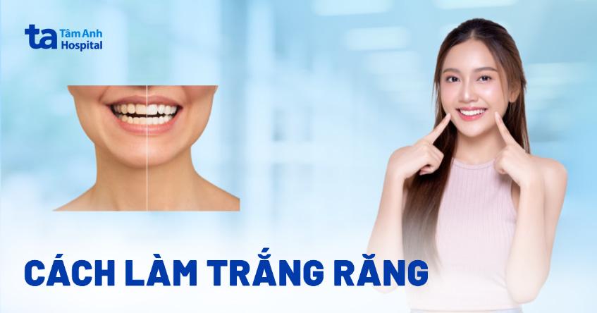 cách làm trắng răng