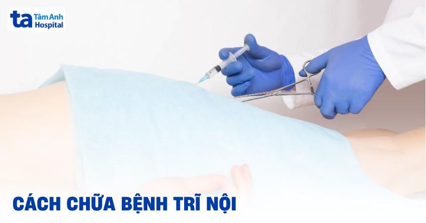 cách chữa bệnh trĩ nội