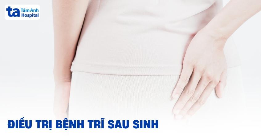 điều trị bệnh trĩ sau sinh