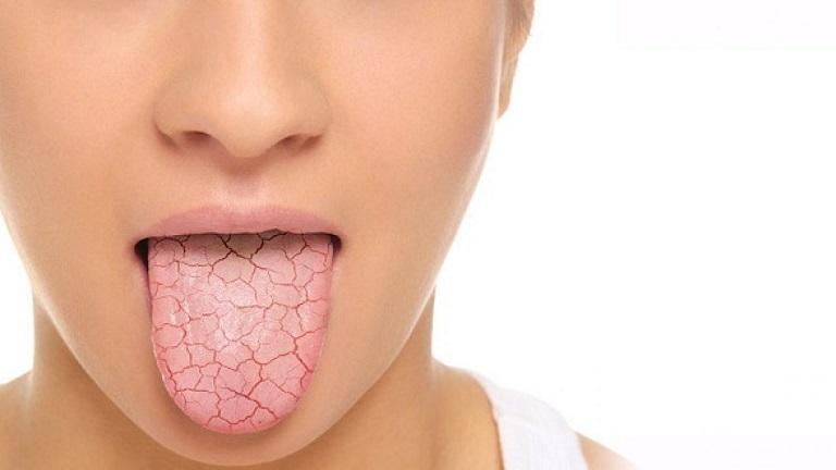 Nhạt miệng, đắng miệng khi ốm là một cảm giác vô cùng khó chịu