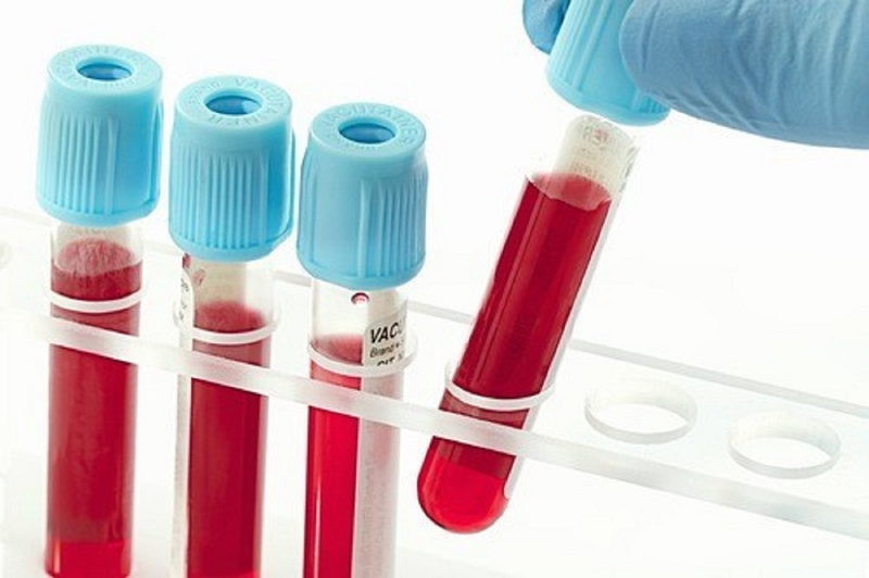 Hướng dẫn cách đọc kết quả định lượng virus viêm gan C bạn cần biết 1