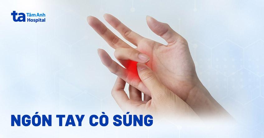 Ngón tay cò súng